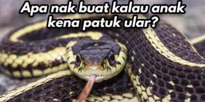 Doktor Kongsikan Perkara Yang Perlu Dibuat Kalau Anak Kena Patuk Ular