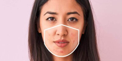 Punca Dan Cara Merawat Jerawat Yang Timbul Sebab Pakai Face Mask