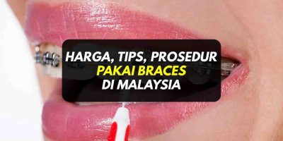 Harga Braces, Prosedur, Tips Pendakap Gigi Di Malaysia