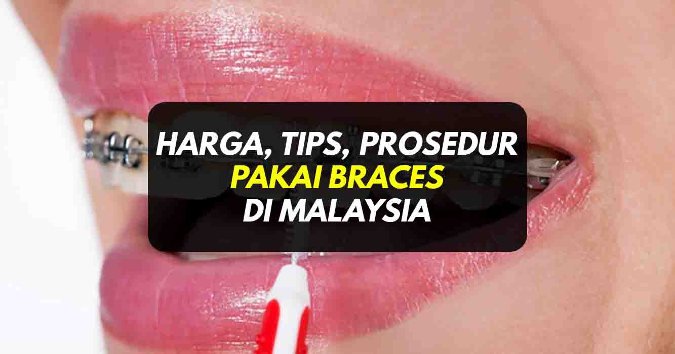 Harga Braces, Prosedur, Tips Pendakap Gigi Di Malaysia