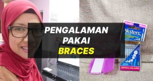 pengalaman pakai braces