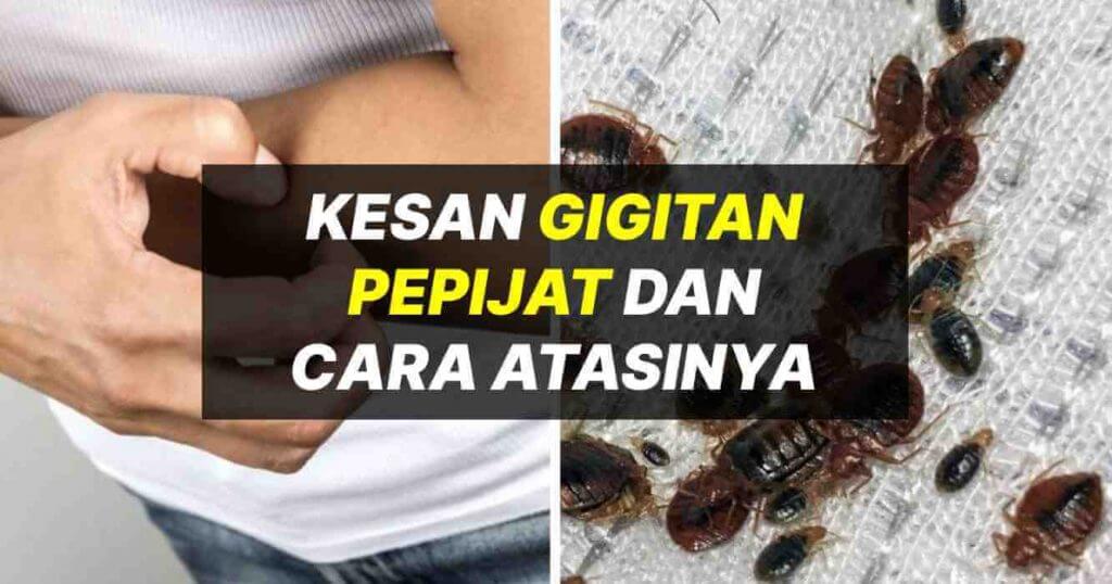 Kesan Gigitan Pepijat & Cara Atasi Gigitan Hama