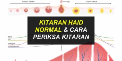 Kitaran Haid Normal & Cara Periksa