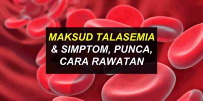 Talasemia Maksud & Cara Rawatannya